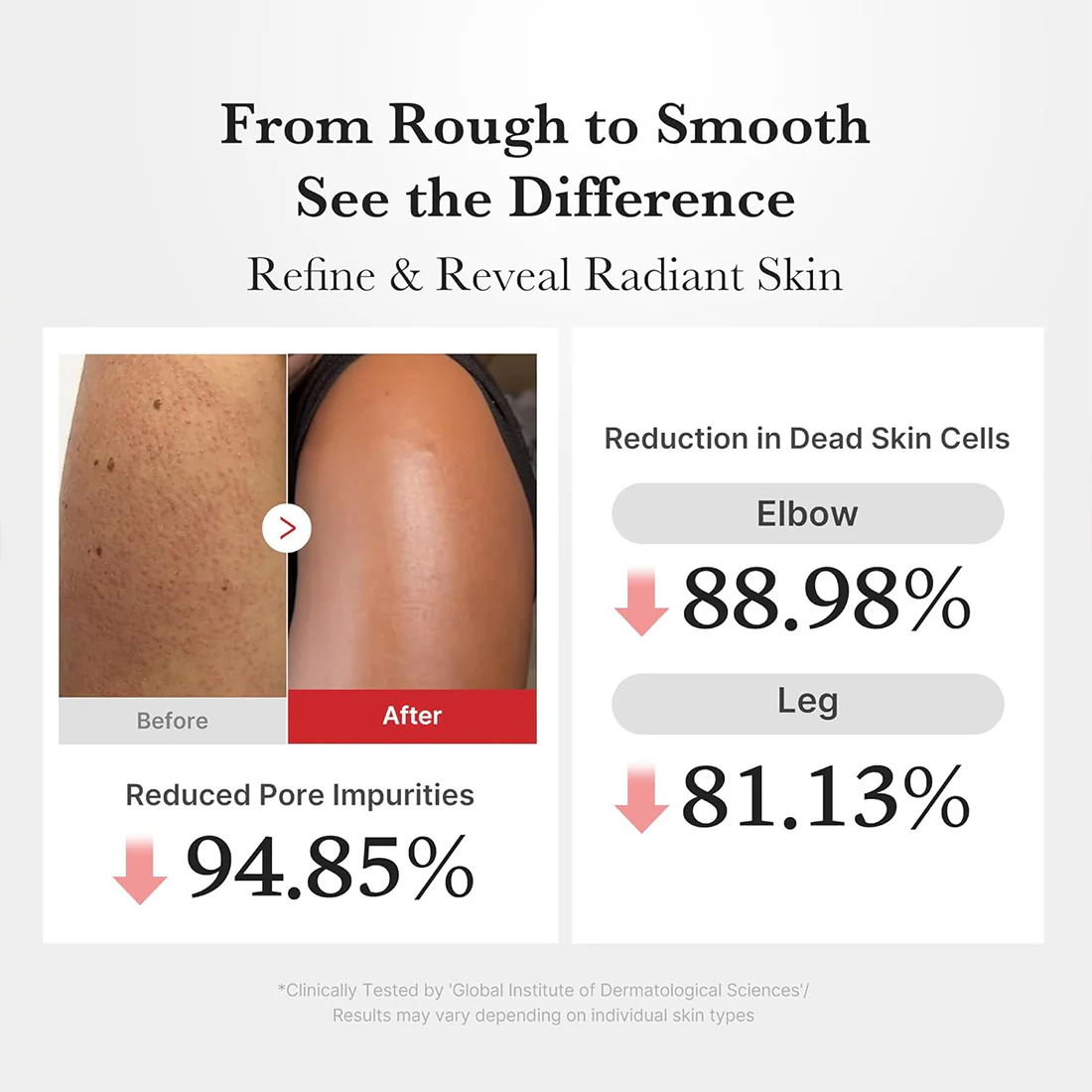 Hypochlorous Acid Body Peel Shot Esfoliante Corpo Anti-Acne e Purificante - Image 4